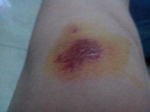 吃瓜伤口流水图片,探究吃瓜伤口流水的奥秘