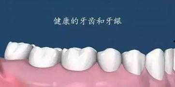 吃瓜洗牙器,健康洗牙——揭秘新型吃瓜洗牙器的神奇魅力